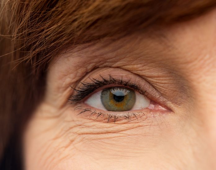 Refractive Lens Exchange at See Vision Eye Institute - Cataract Surgery Alternative